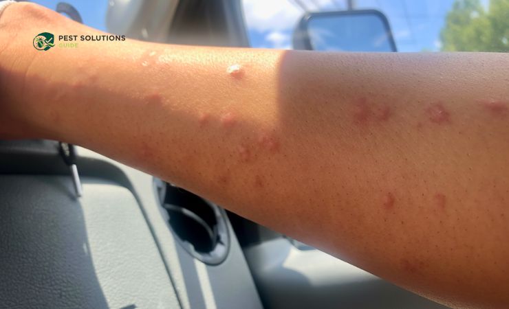 5 Signs You Have Bed Bugs in Your Car
