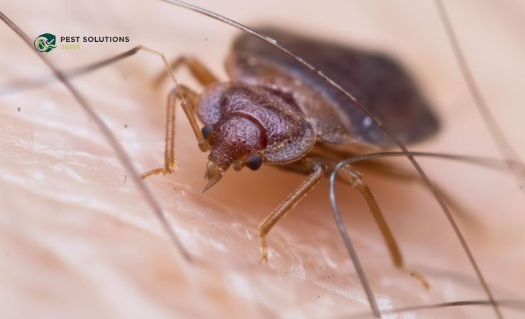 Simple Steps to Remove Bed Bugs from Hair